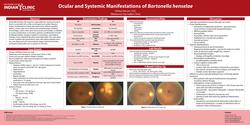 Ocular and Systemic Manifestations of Baronella henselae